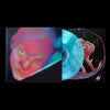 Fontaines D.C. - Dopamine Chamber (Ltd. Ed. Blue Marble Vinyl) - Blind Tiger Record Club